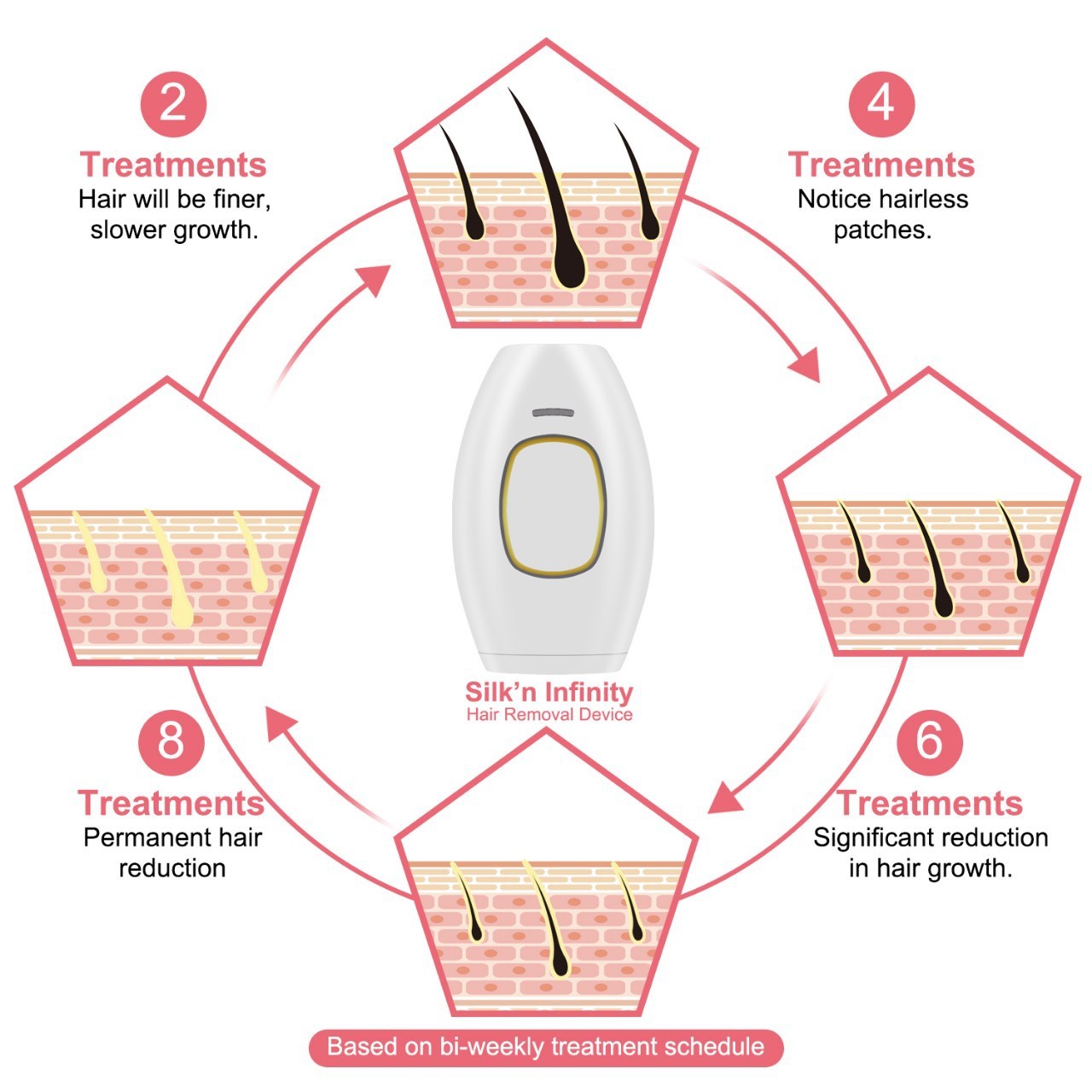 Magán: Home Use Laser Hair Removal Device